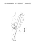 HIP OBTURATOR AND METHOD FOR ATRAUMATIC HIP ACCESS diagram and image