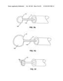 ENDOSCOPIC DEVICES AND RELATED METHODS OF USE diagram and image