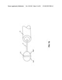 ENDOSCOPIC DEVICES AND RELATED METHODS OF USE diagram and image