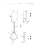 ENDOSCOPIC DEVICES AND RELATED METHODS OF USE diagram and image