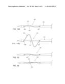 SYSTEMS AND METHODS FOR CABLE-BASED TISSUE REMOVAL diagram and image