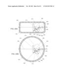 SYSTEMS AND METHODS FOR CABLE-BASED TISSUE REMOVAL diagram and image