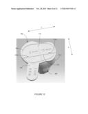 PATIENT-SPECIFIC INSTRUMENTATION AND METHOD FOR ARTICULAR JOINT REPAIR diagram and image