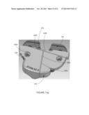 PATIENT-SPECIFIC INSTRUMENTATION AND METHOD FOR ARTICULAR JOINT REPAIR diagram and image