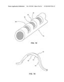 MEDICAL RETRIEVAL DEVICES diagram and image