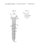 METHODS FOR STABILIZING BONE USING SPINAL FIXATION DEVICES diagram and image