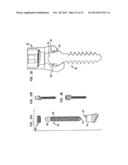 METHODS FOR STABILIZING BONE USING SPINAL FIXATION DEVICES diagram and image