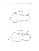 VARYING DIAMETER VASCULAR IMPLANT AND BALLOON diagram and image