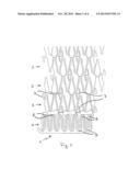 STENT GRAFT diagram and image