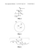 APPARATUS FOR CREATING INCISIONS TO IMPROVE INTRAOCULAR LENS PLACEMENT diagram and image