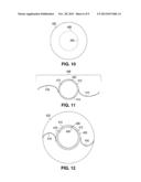 APPARATUS FOR CREATING INCISIONS TO IMPROVE INTRAOCULAR LENS PLACEMENT diagram and image