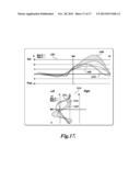 SELF-ALIGNING PROSTHESIS WITH HYDRAULIC ACTUATORS diagram and image