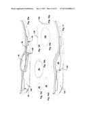 DYNAMIC ARCH STABILIZATION AND REHABILITATIVE SHOE MIDSOLE/INSOLE DEVICE diagram and image