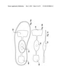 DYNAMIC ARCH STABILIZATION AND REHABILITATIVE SHOE MIDSOLE/INSOLE DEVICE diagram and image