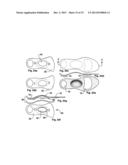 DYNAMIC ARCH STABILIZATION AND REHABILITATIVE SHOE MIDSOLE/INSOLE DEVICE diagram and image