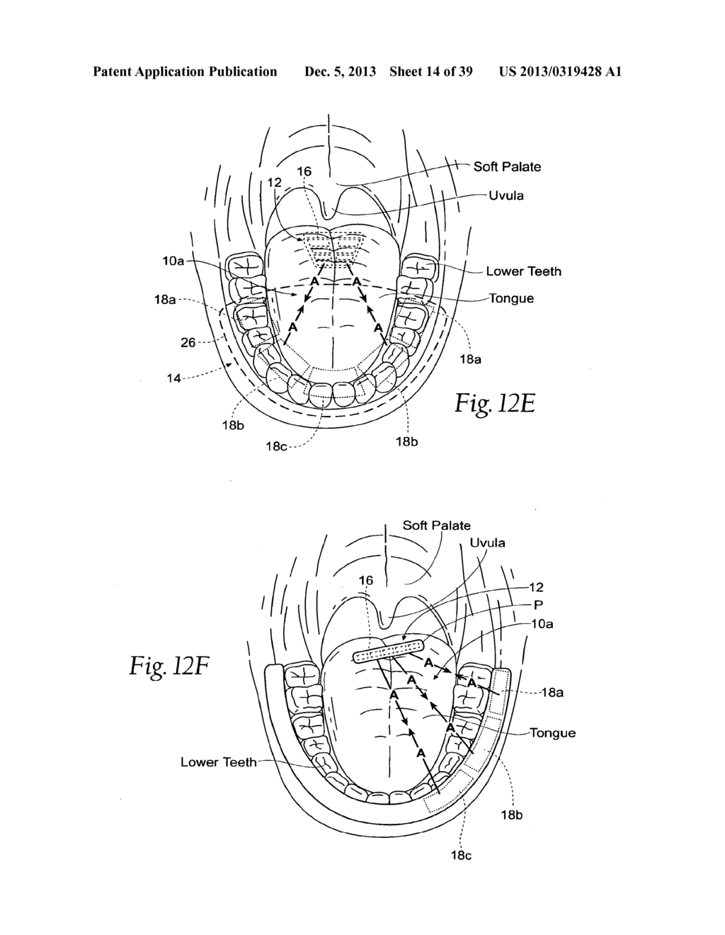 STABILIZED MAGNETIC FORCE DEVICES, SYSTEMS AND METHODS - diagram, schematic, and image 15