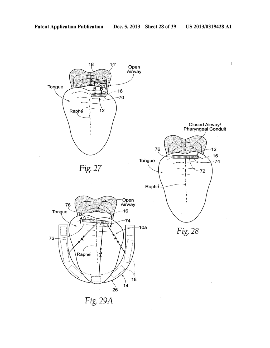 STABILIZED MAGNETIC FORCE DEVICES, SYSTEMS AND METHODS - diagram, schematic, and image 29