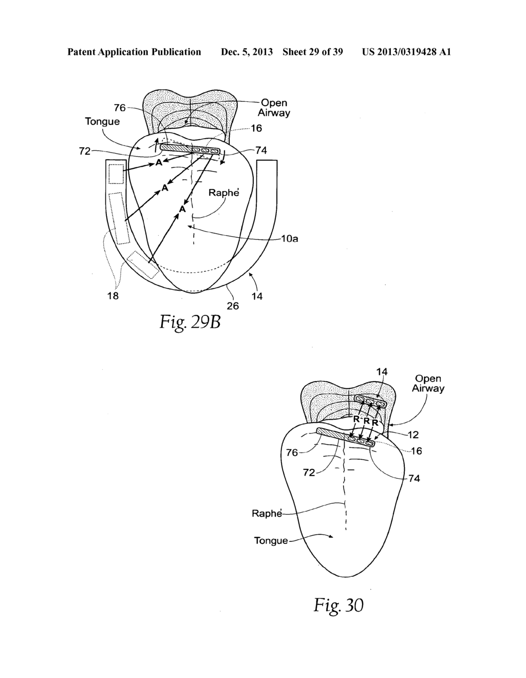 STABILIZED MAGNETIC FORCE DEVICES, SYSTEMS AND METHODS - diagram, schematic, and image 30