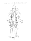 Fall Arrest Apparatus diagram and image