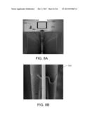 PREPARATION OF LAMELLAE FOR TEM VIEWING diagram and image