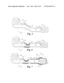 Flexible Circuit Electrode Array and Method of Manufacturing the Same diagram and image