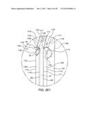 Fastening tool nail stop diagram and image