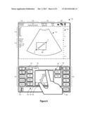 SYSTEMS AND METHODS FOR INTERFACING WITH AN ULTRASOUND SYSTEM diagram and image