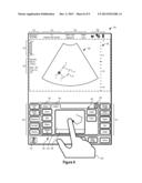 SYSTEMS AND METHODS FOR INTERFACING WITH AN ULTRASOUND SYSTEM diagram and image