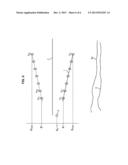 METHOD AND DEVICE TO ACQUIRE MARINE SEISMIC DATA diagram and image