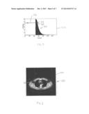 METHODS AND SYSTEMS FOR LOCATING A REGION OF INTEREST IN AN OBJECT diagram and image