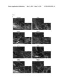 Combination Treatments and Compositions for Wound Healing diagram and image