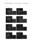 Combination Treatments and Compositions for Wound Healing diagram and image