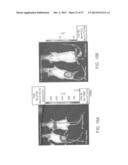 ADHERENT CELLS FROM ADIPOSE OR PLACENTA TISSUES AND USE THEREOF IN THERAPY diagram and image