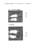 ADHERENT CELLS FROM ADIPOSE OR PLACENTA TISSUES AND USE THEREOF IN THERAPY diagram and image