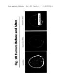 THERAPEUTIC COMPOSITION FOR TREATMENT OF GLIOBLASTOMA diagram and image