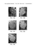 ISOLATED ADULT CELLS, ARTIFICIAL ORGANS, REHABILITATED ORGANS, RESEARCH     TOOLS, ORGAN ENCASEMENTS, ORGAN PERFUSION SYSTEMS, AND METHODS FOR     PREPARING AND UTILIZING THE SAME diagram and image