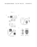 BIOMARKERS AND THERAPEUTIC TARGETS FOR TREATING CARDIOMYOPATHIES AND     CONGESTIVE HEART FAILURE diagram and image