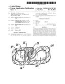 METHOD AND DEVICE FOR PERCUTANEOUS LEFT VENTRICULAR RECONSTRUCTION diagram and image