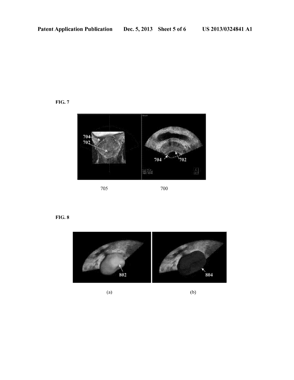 System and Method for Real-Time Ultrasound Guided Prostate Needle Biopsy     Based on Biomechanical Model of the Prostate from Magnetic Resonance     Imaging Data - diagram, schematic, and image 06