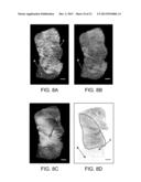 DEVICES AND METHODS FOR OPTICAL PATHOLOGY diagram and image