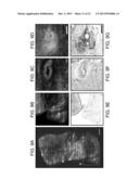 DEVICES AND METHODS FOR OPTICAL PATHOLOGY diagram and image