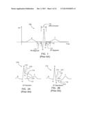 SYSTEMS AND METHODS FOR GRAPHIC DISPLAY OF ST-SEGMENT DEVIATION diagram and image