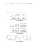 SYSTEMS AND METHODS FOR GRAPHIC DISPLAY OF ST-SEGMENT DEVIATION diagram and image