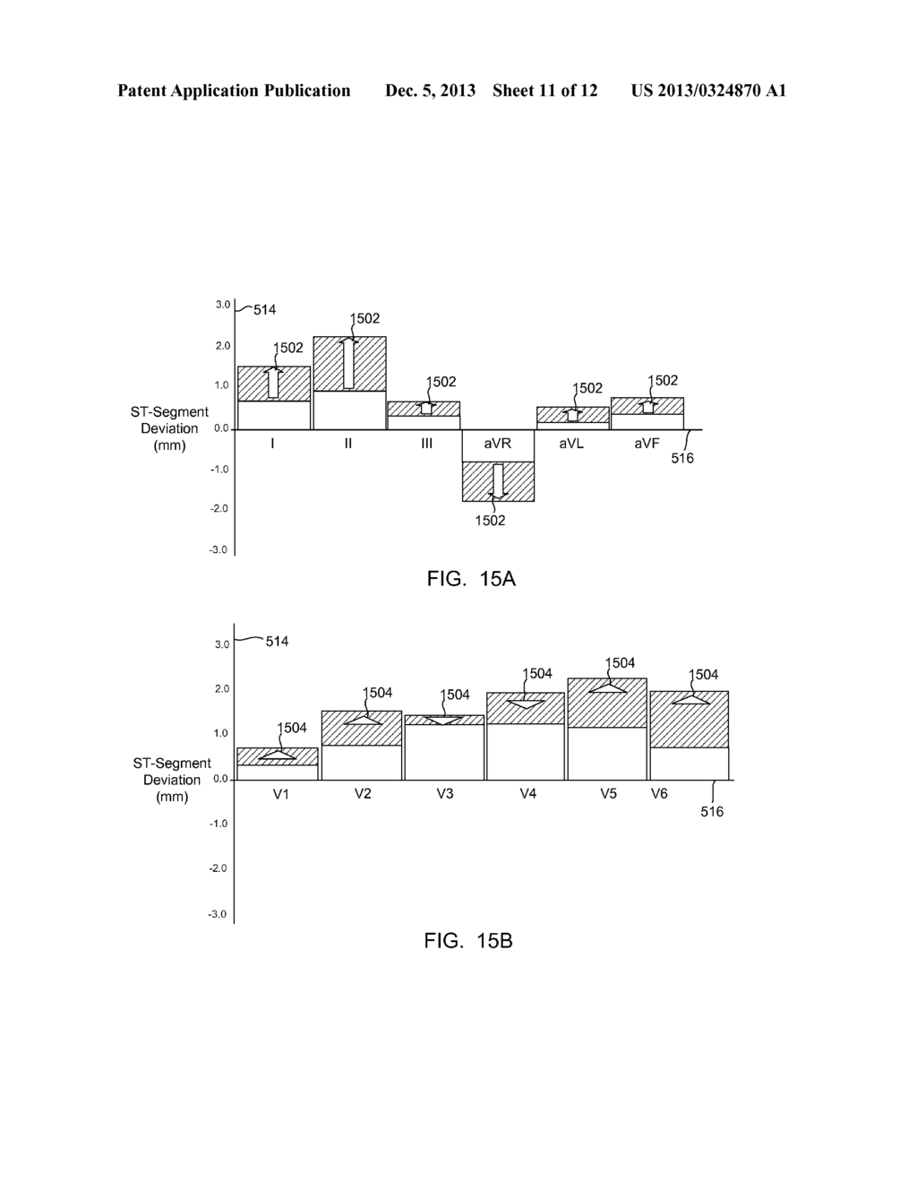 SYSTEMS AND METHODS FOR GRAPHIC DISPLAY OF ST-SEGMENT DEVIATION - diagram, schematic, and image 12