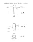 DEVICES AND METHODS FOR GASTROINTESTINAL BYPASS diagram and image