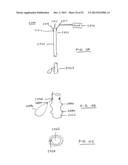 DEVICES AND METHODS FOR GASTROINTESTINAL BYPASS diagram and image