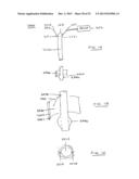 DEVICES AND METHODS FOR GASTROINTESTINAL BYPASS diagram and image