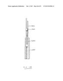 DEVICES AND METHODS FOR GASTROINTESTINAL BYPASS diagram and image