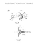 DEVICES AND METHODS FOR GASTROINTESTINAL BYPASS diagram and image