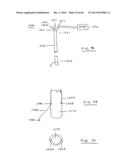 DEVICES AND METHODS FOR GASTROINTESTINAL BYPASS diagram and image